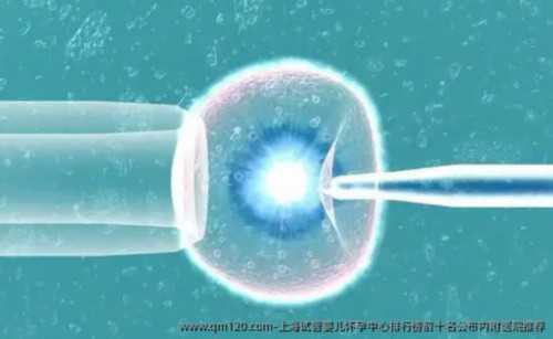 供卵代孕婴儿全下来费用大概要多少钱